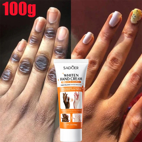 Creme Clareador De Pigmentação Dark Knuckles Ui
