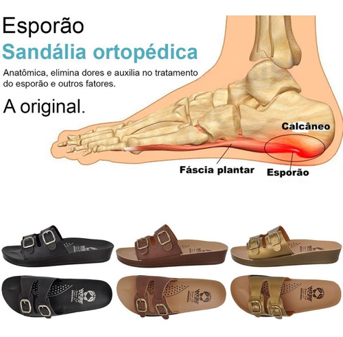 sandalia ortopedica para esporao