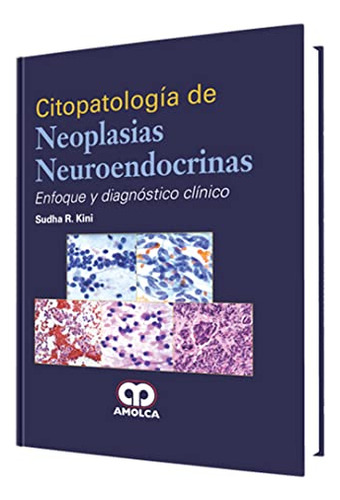 Libro Citopatología De Neoplasias Neuroendócrinas  De Sudha