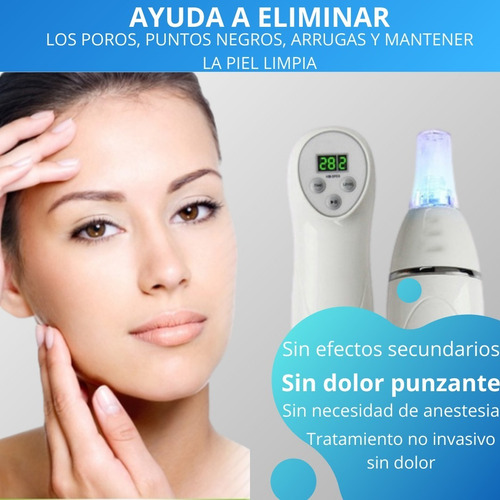 Microdermoabrasion Punta Diamante Quita Puntos Negros 6 En 1