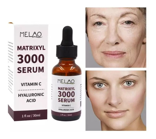 Sérum Matrixyl 3000 Vitamina C Y Ácido Hialurónico Colágeno
