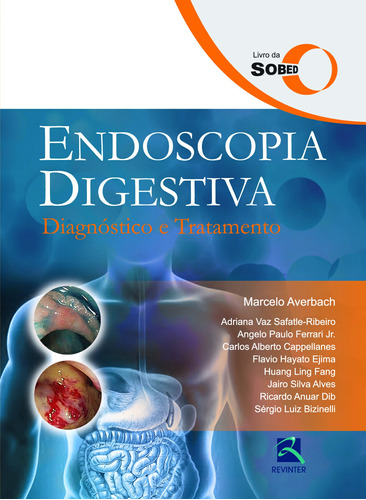 Endoscopia Digestiva: Diagnóstico e Tratamento, de Sociedade Brasileira de Endoscopia Digestiva. Editora Thieme Revinter Publicações Ltda, capa dura em português, 2015