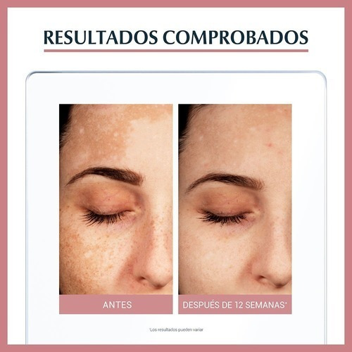 Imagen 6 de 9 de Eucerin Anti-pigment Serum Dual Facial Antimanchas X 30 Ml