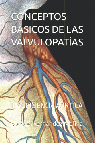 Libro: Conceptos Basicos De Las Valvulopatías: Insuficiencia
