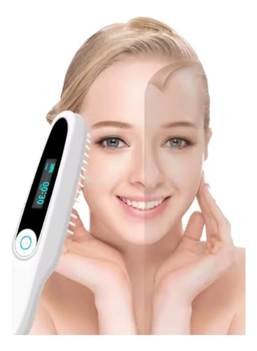 Lámpara Fototerapia Uvb Para Vitíligo Y Psoriasis Con Timer