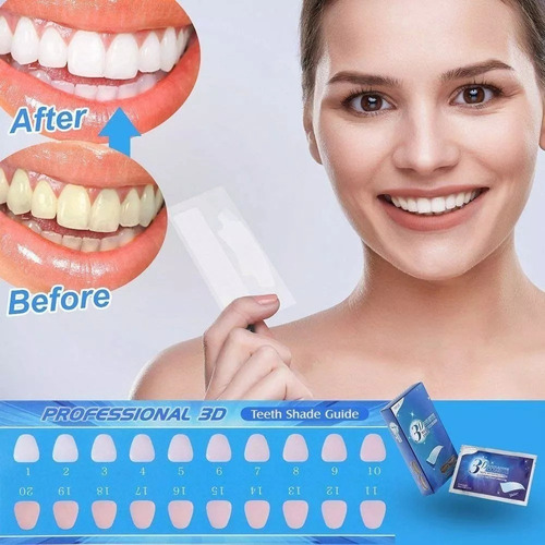 U Tiras Blanqueadoras De Dientes 3d (42 Tiras)