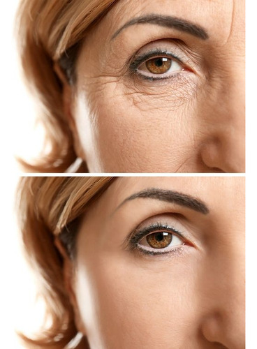 Crema Anti-age/retinol/ácido Hialurónico/+ 6 Aceites Puros