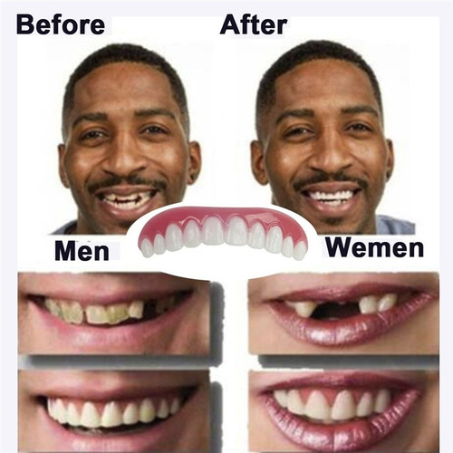 Dientes Perfectos Falsos, Dentadura Superior Falsa,  Sonrisa