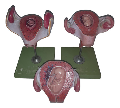 Utero Con Feto Gestacion 3 Modelos Anatomia Somso Alemania (Usado)