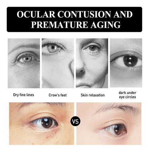 Crema De Ojos Reductora De Arrugas F Crema Reparadora De Ojo