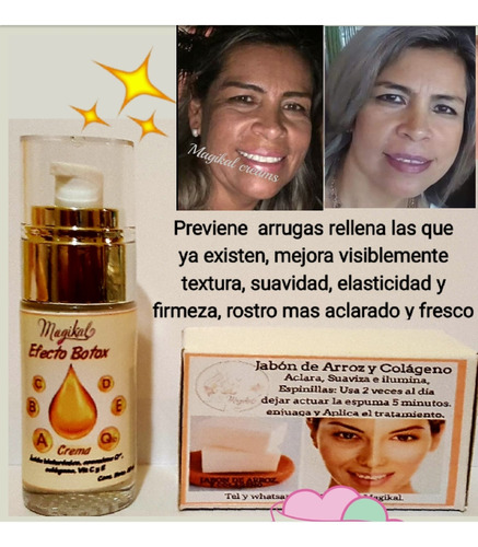 2cremas Efecto Botox Anti-arrugas Previene,rellena, Alisa