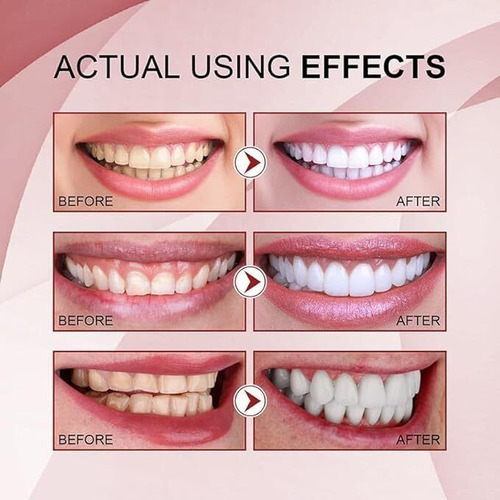 - Creme Dental Probiótico Sp-4 De Clareamento Rápido