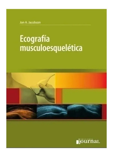 Ecografia Musculoesqueletica Jacob