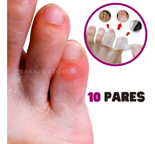 Imagem 1 de 8 de 10 Pares Protetor De Calosidade Da Lateral Do Dedo Anti Calo