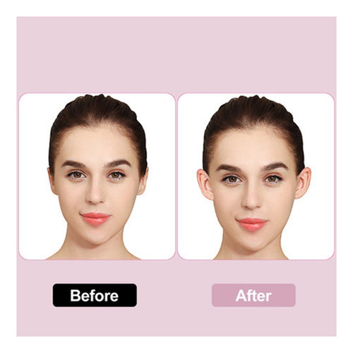 A Pegatinas For Orejas Beauty Ear Corrector Lug Solutions