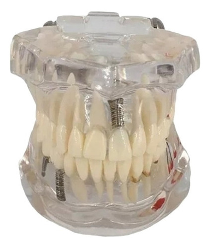 Manequim Ortodontista Macro Dental Modelo Odonto Orto