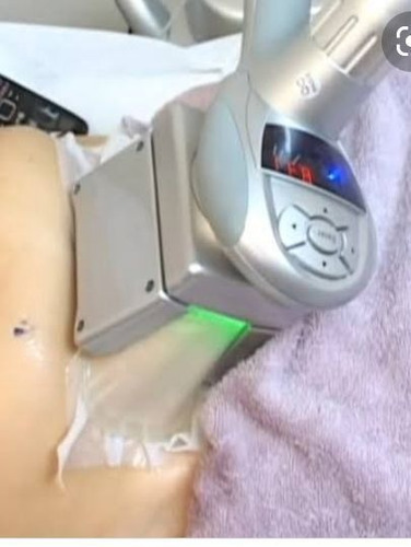Imagem 3 de 5 de Locação De Aparelho Polarys Ibramed De Cliolipolise Novo