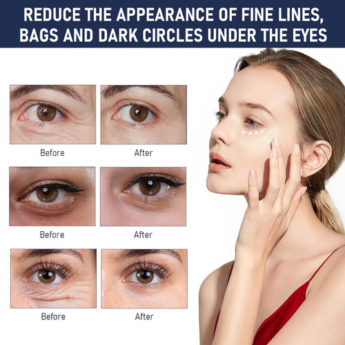 2 Piezas De Suero Para Ojos De Reducción Rápida