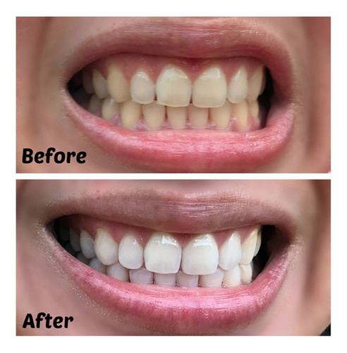 N Pasta De Dientes De Carbón Activado E Bamboo Charcoal