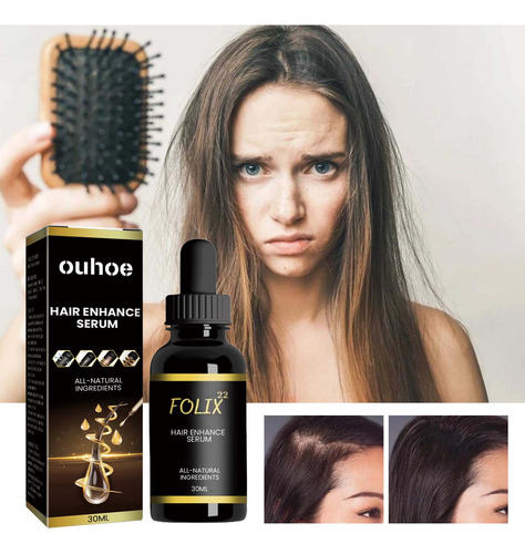S Hair Growth Formula, Hair Growth Serum,hair Growth Oi 1011