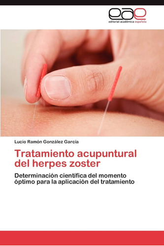 Libro: Tratamiento Acupuntural Del Herpes Zoster: Determinac