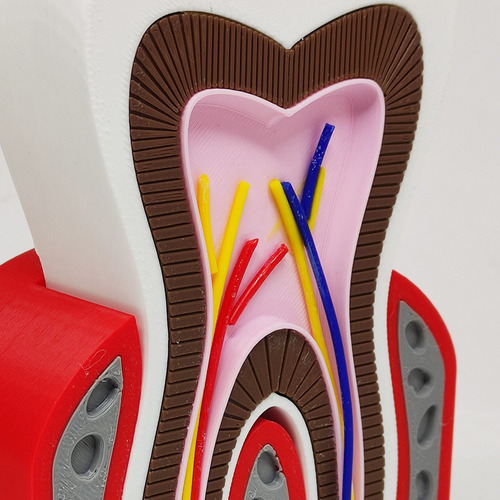 Modelo Dentário Anatomia Raiz Gengiva Osso Dente Nervos