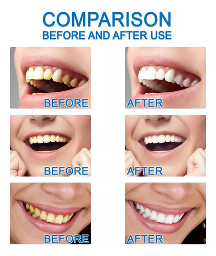 EssĂȘncia Branqueadora De Dentes, Limpeza E Higiene Bucal, R