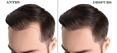 Loción Noxidil-h2 The Shaving Co Sistema Regenerador. Anticaida. Alopesia. Contiene Vitaminas.