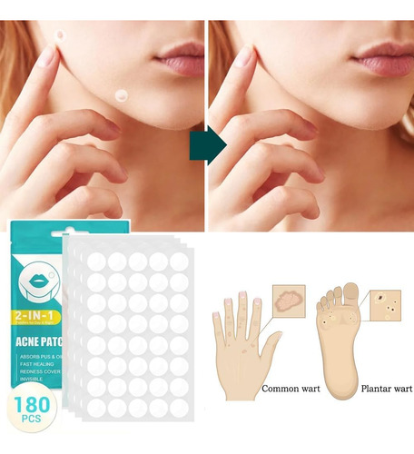 180 Parches Para Acné. Pimple Patch, Calcomanías Ultra