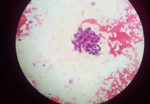 Imagen 3 de 6 de Harris Hematoxilin_a
