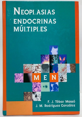 Neoplasias Endocrinas Multiples Tebar