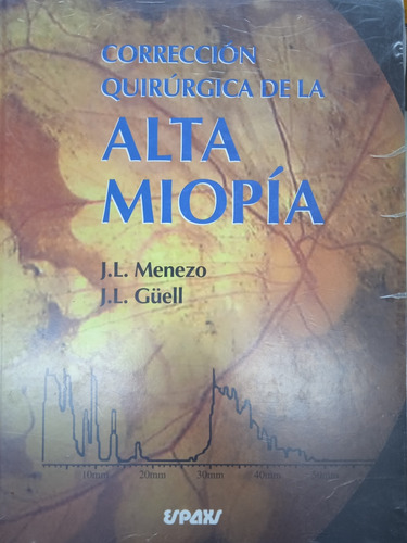 Corrección Quirúrgica De La Alta Miopía / Menezo Y Güell