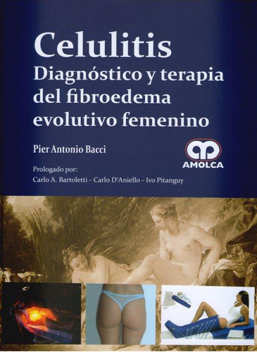 Celulitis Diagnostico Terapia Fibroedema Evolutivo