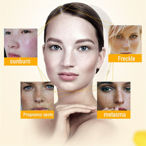 Creme Facial Clareador Hidratante, Clareador E Clareador Fac