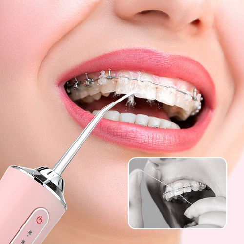Imagen 4 de 10 de Irrigador Limpiador Dental Oral Bucal Y Brackets Uso Diario