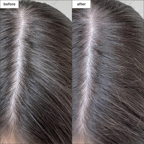 ChampĂș Seco Briogeo Scalp Revival Charcoal Biotin | Seco