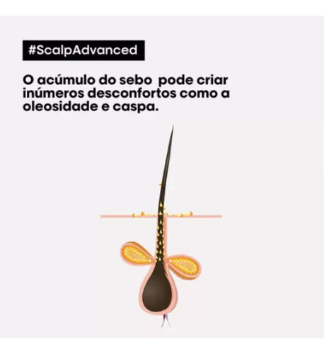 Shampoo Loreal Scalp Advanced Anti-gras Anti Oleosidade 300m