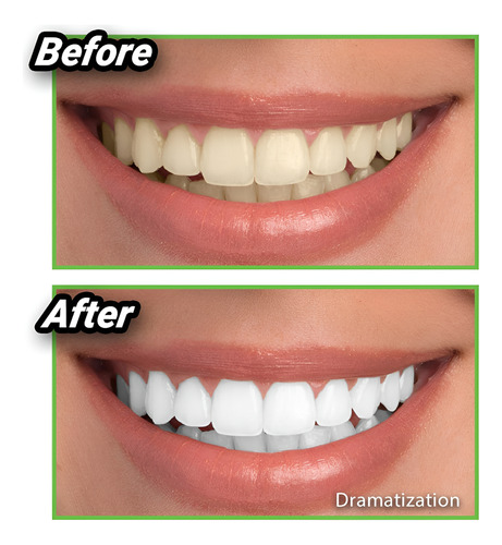 Blanqueador Dental Limpieza Dientes Polvo Carbón Coco Menta