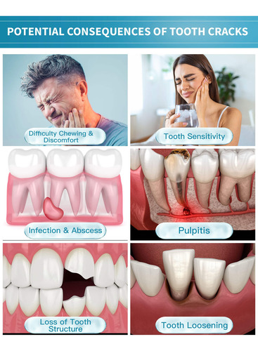 Pasta De Dientes Caredo 100g Para Dientes Agrietados Y