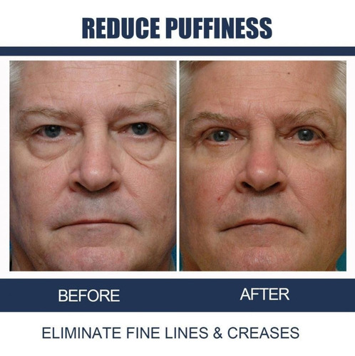 2 Peças De Creme De Olhos Masculino Reparador De Olhos