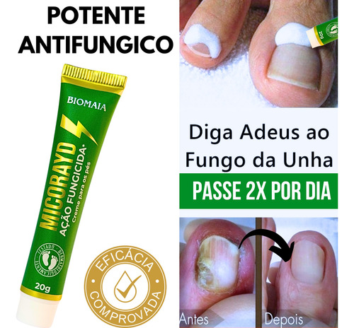 Micorayd Melhor Que Decreina Frieiras Micoses Fungos