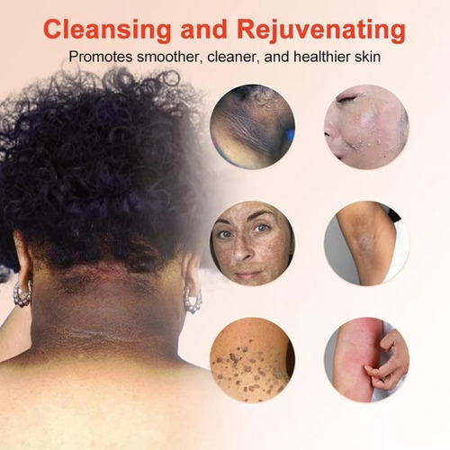 Quarxeri Purificante Exfoliante, Gel Exfoliante Avanzado 2 P