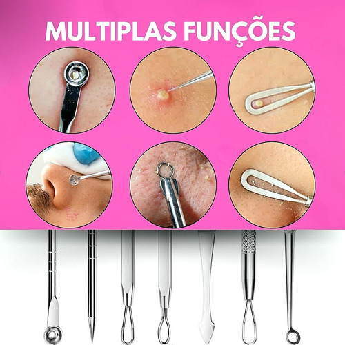 Extração Cravos Espremendo Cravos Espinhas
