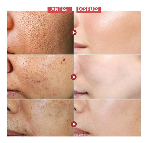 Serum Suero Con Acido Hialuronico Vitamina E Antimanchas