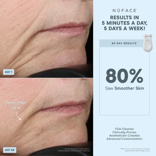 Attachment Nuface Para Labios Y Ojos De Trinit, Aprobado Por