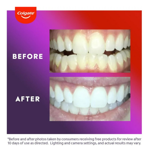 Colgate Optic White Comfortfit Led Teeth Whitening Kit