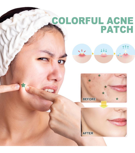 Pimples Patch, Parches De Grado Profesional Para El Acné