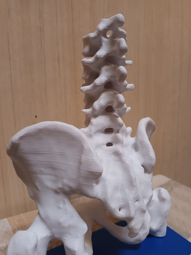 Anatomía Humana: Fémur Y Pelvis Femenina