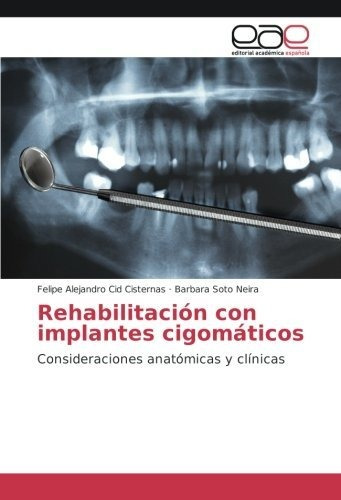 Rehabilitación Con Implantes Cigomáticos: Consideraciones An