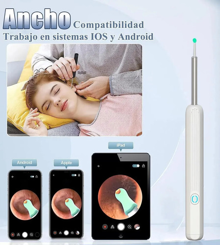 Limpiador Oídos Cámara Hd Inalámbrica Recargable Endoscopio